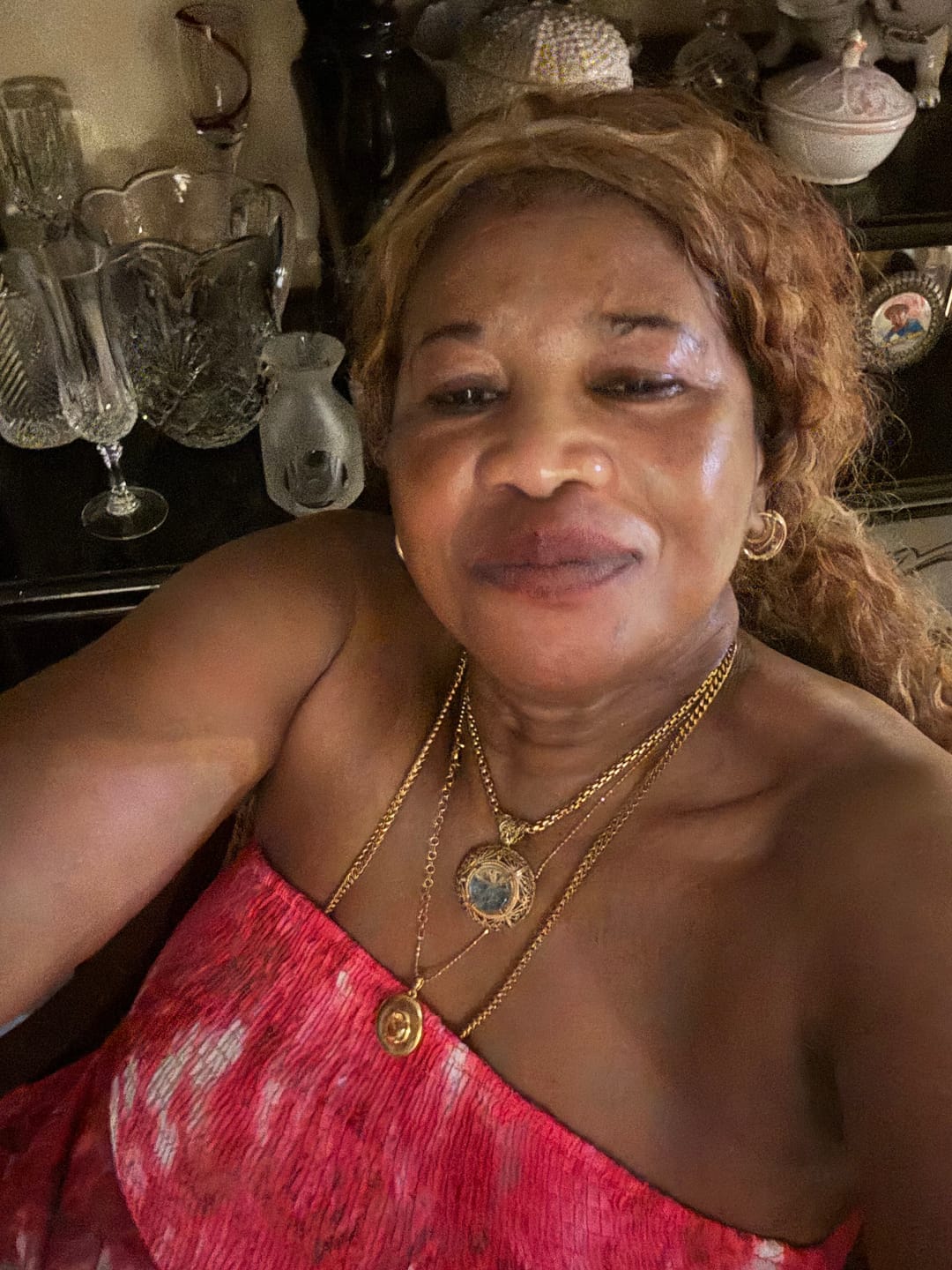 Customer photo review of Perfect Skin Tone Dark Spot Capsules