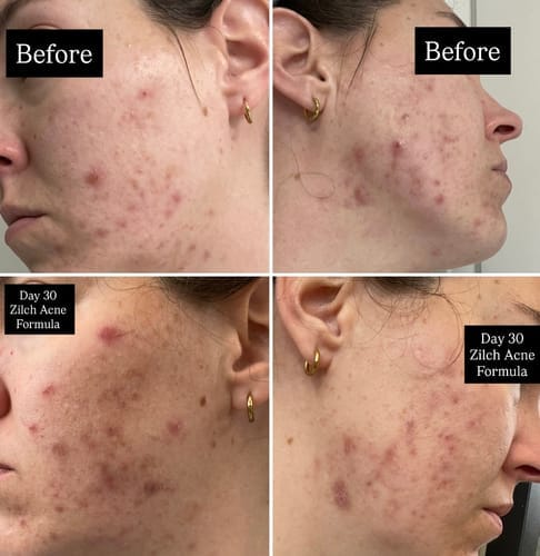 Customer photo review of Skin Formula