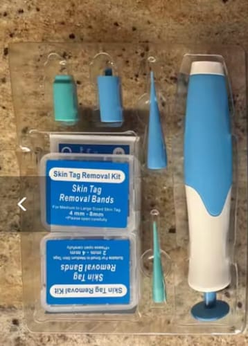 Customer photo review of Schmerzfreies Stielwarzen-Entfernungsset