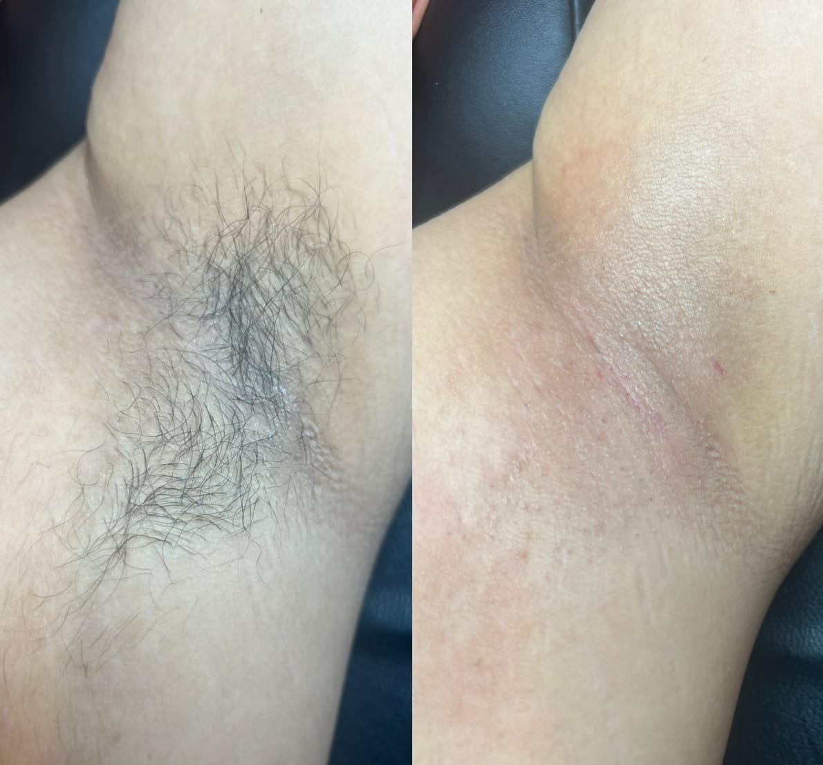 Customer photo review of Dermave™ Electric Trimmer 2.0 for Men