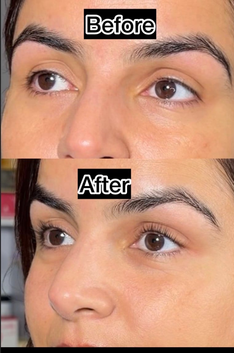 Customer photo review of Lashlift Starter Set