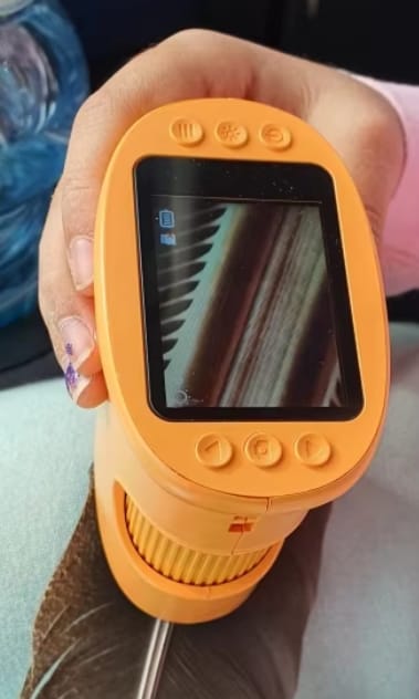 Customer photo review of HD子どもスコープ