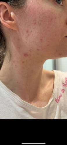 Customer photo review of Skin Formula
