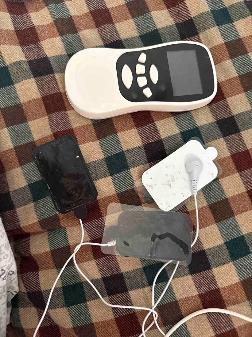 Customer photo review of Manyetify™ - TENS/EMS Masaj Aleti