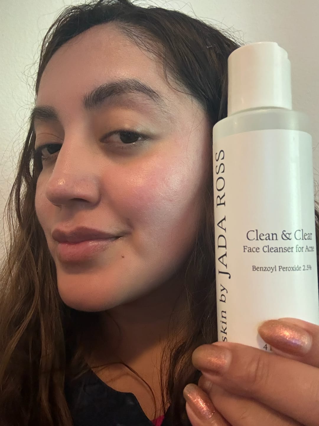 Customer photo review of Soothing Acne Mask