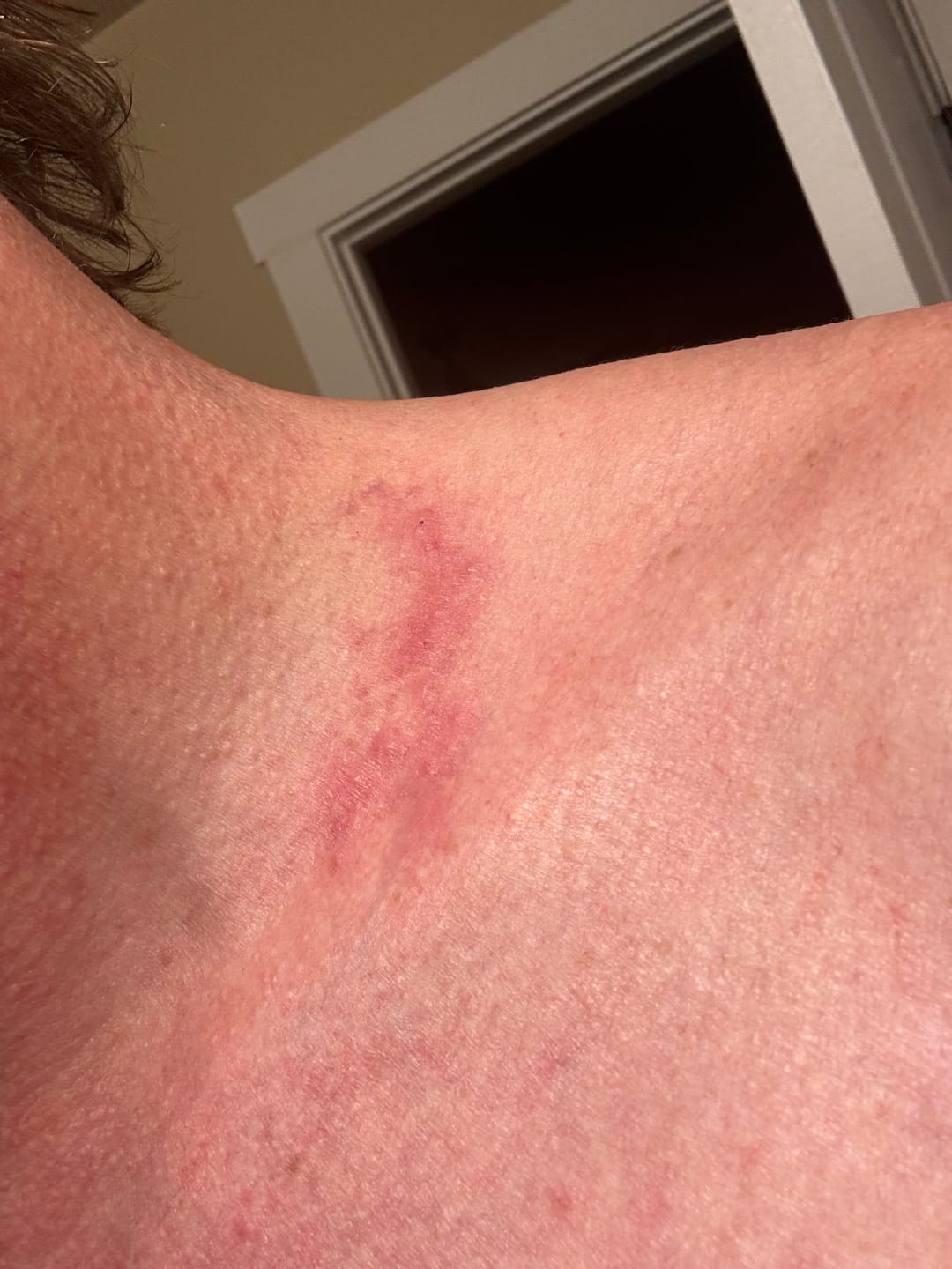 Customer photo review of Facial Moisturizing Cream
