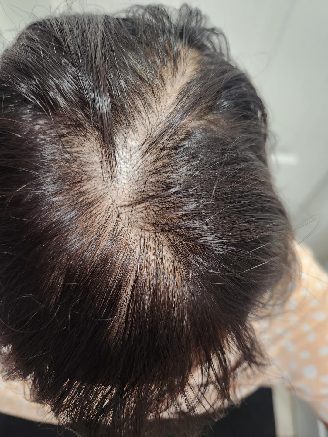 Customer photo review of SHAMPOING NATUREL AU ROMARIN ET À LA KÉRATINE — POUR DES CHEVEUX PLUS ÉPAIS ET PLUS VOLUMINEUX