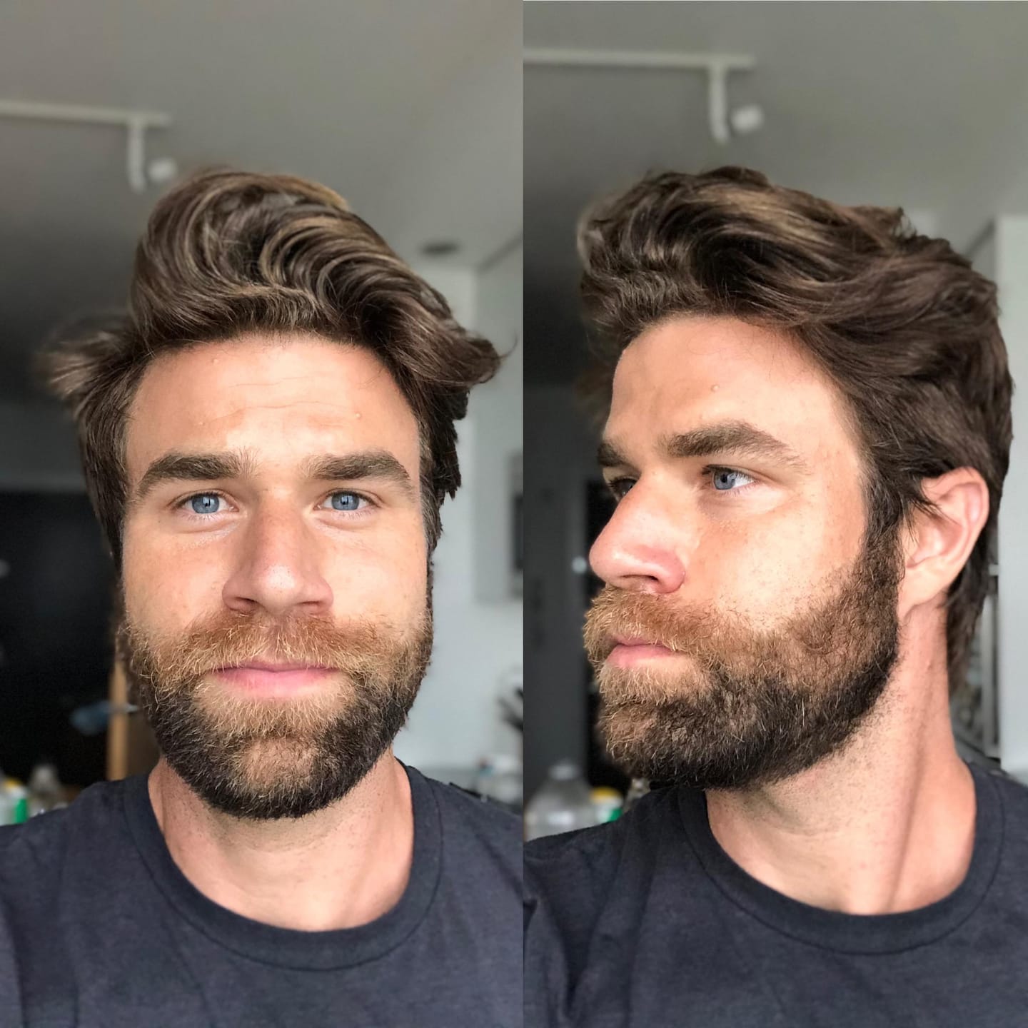 Customer photo review of Reverse - Beard Growth Serum
