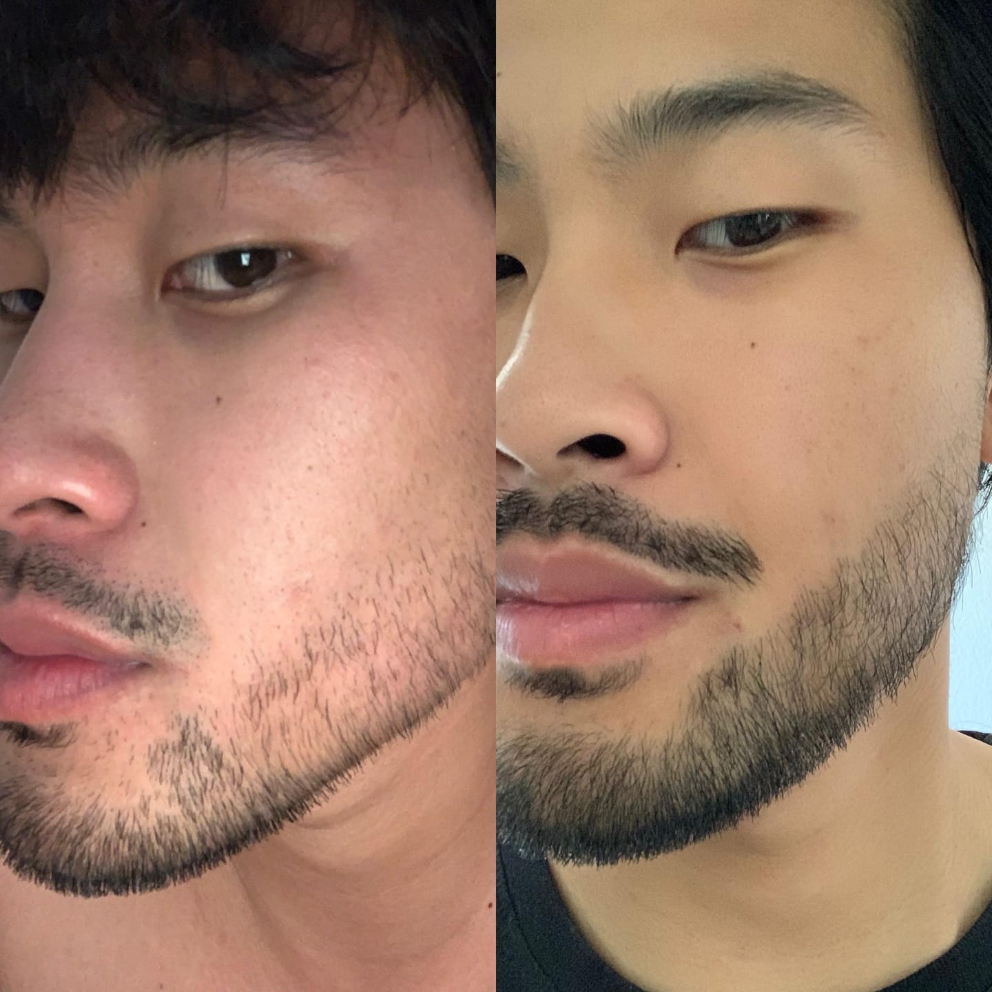 Customer photo review of Reverse - Beard Growth Serum