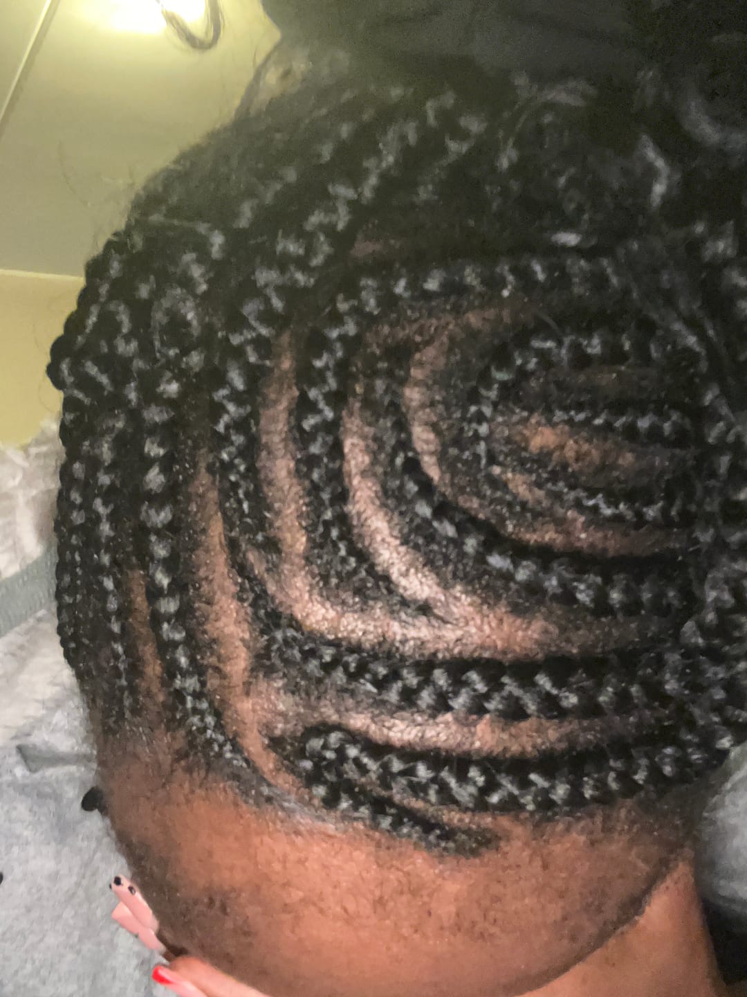 Customer photo review of Minoxidil High Strength (5%) SOLUTION, 3x60ml pack
