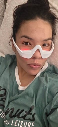 Customer photo review of Puffy Eye Massager Glasses