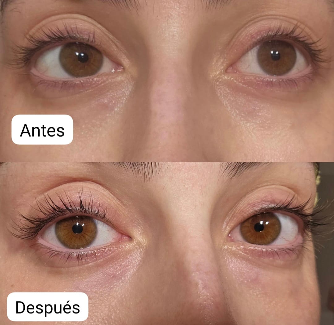 Customer photo review of KosmaLash® | Sérum Crecimiento & Anticaída