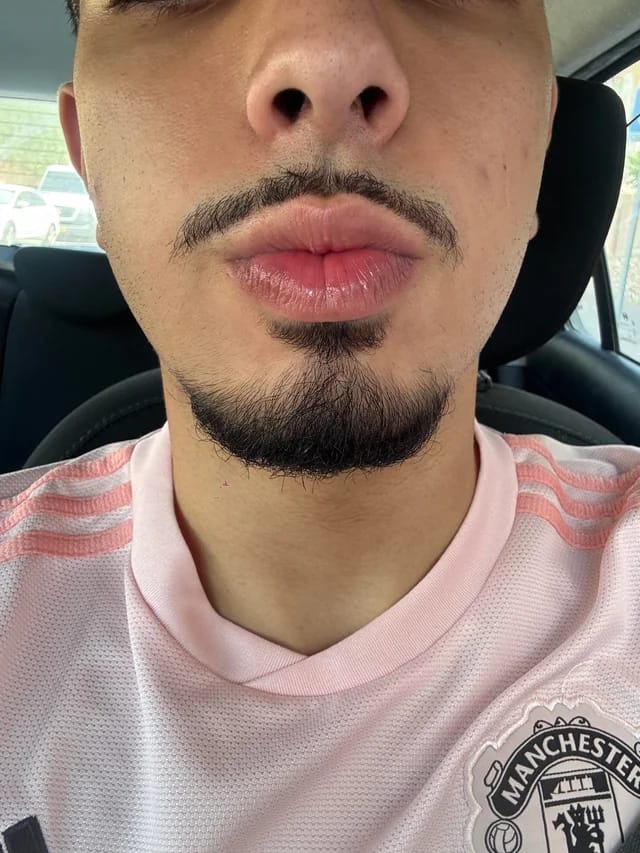 Customer photo review of Reverse - Beard Growth Serum