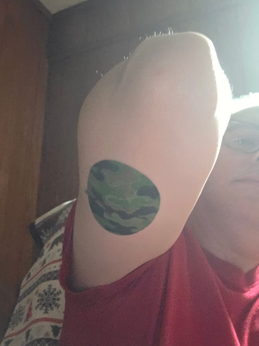 Customer photo review of Skin Grip Original - Dexcom G7 & Stelo Adhesive Patches