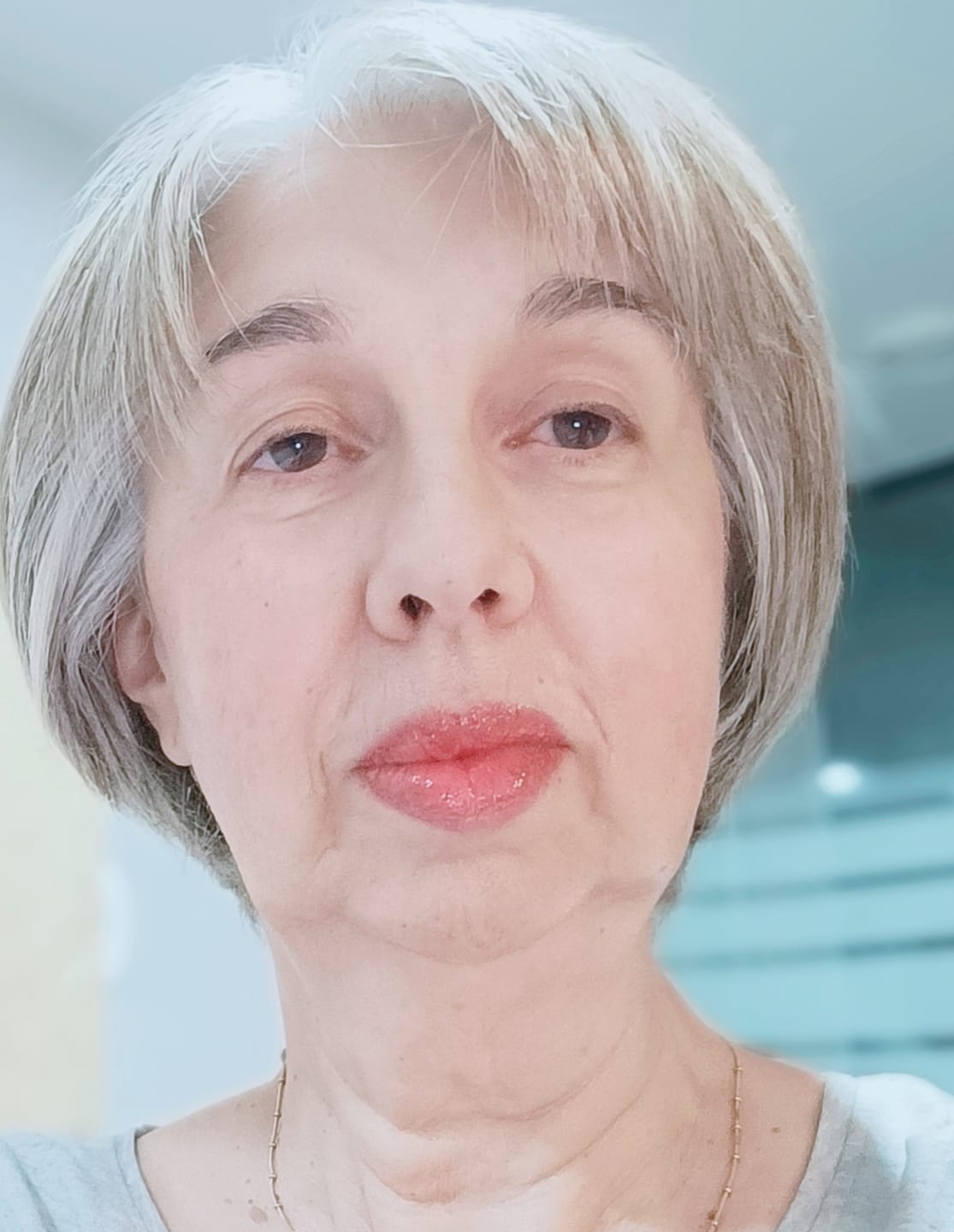 Customer photo review of Bálsamo de Cálcio 4 em 1 Efeito Lifting Instantâneo - CALCIUM LUXE™
