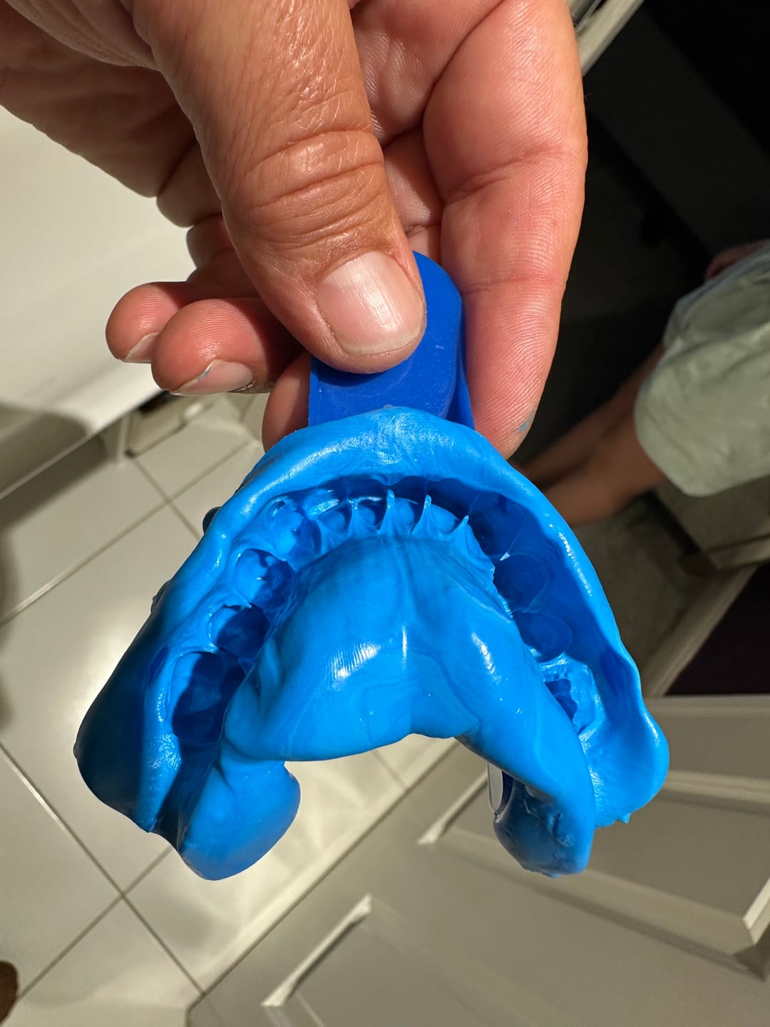 Customer photo review of Professional Whitening Trays