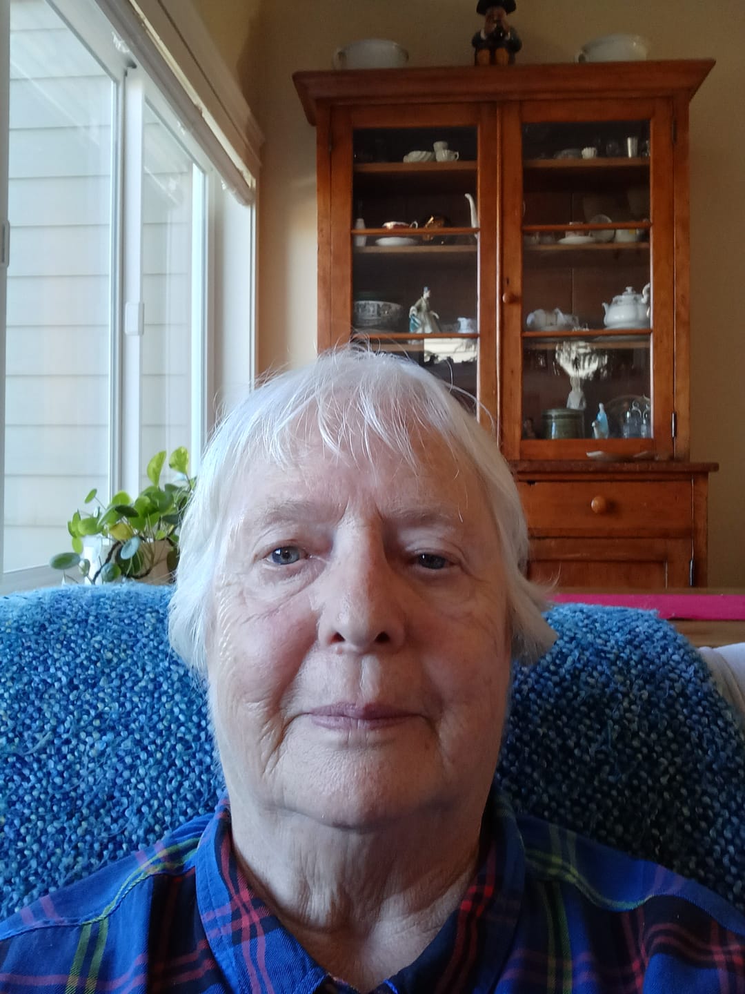Customer photo review of Face Serum (Night, Lactic Acid 10%)