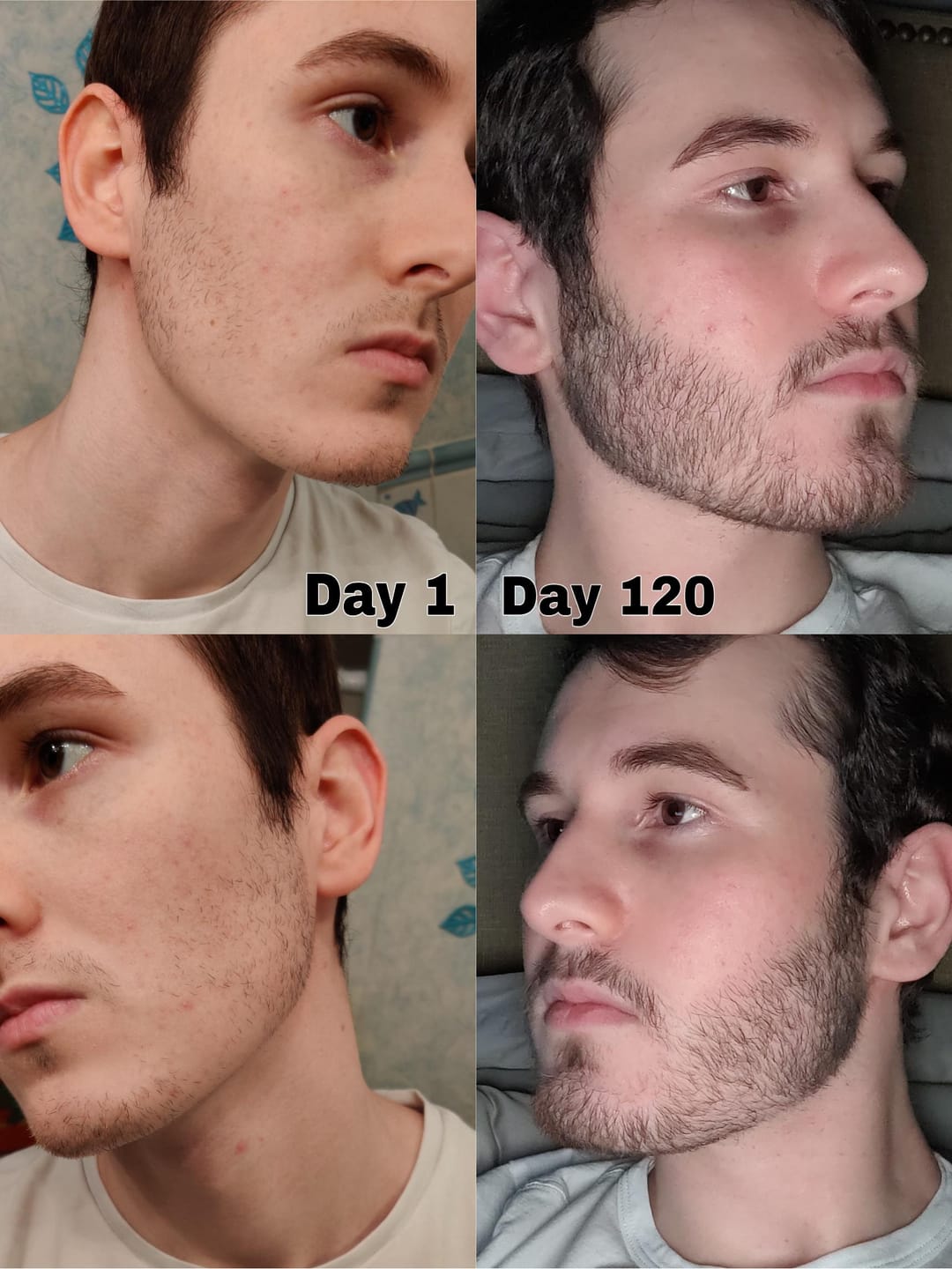 Customer photo review of Reverse - Beard Growth Serum