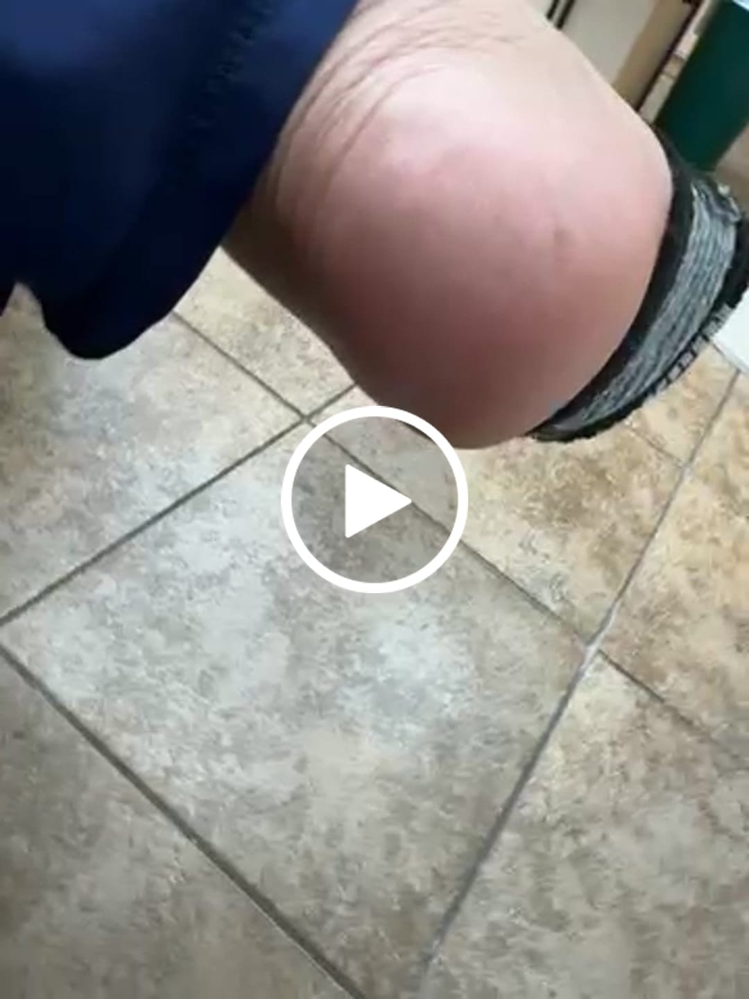 Customer video review of Foot Balm