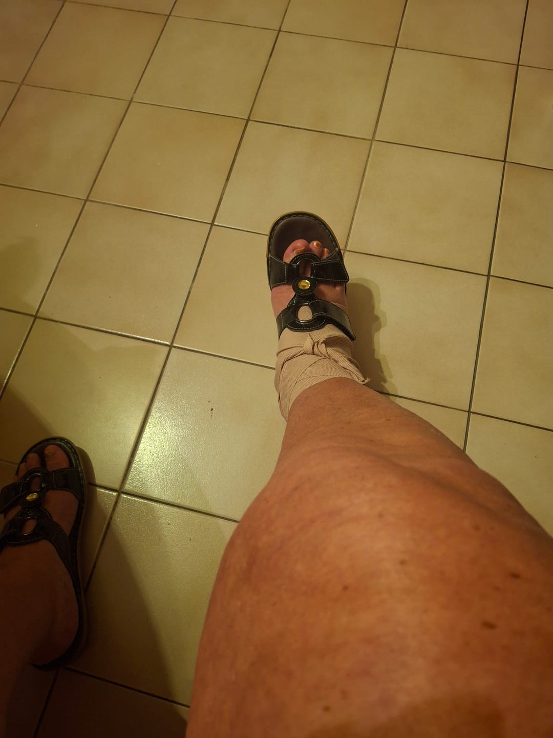 Customer photo review of Genouillère de Compression