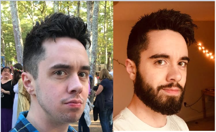 Customer photo review of Reverse - Beard Growth Serum