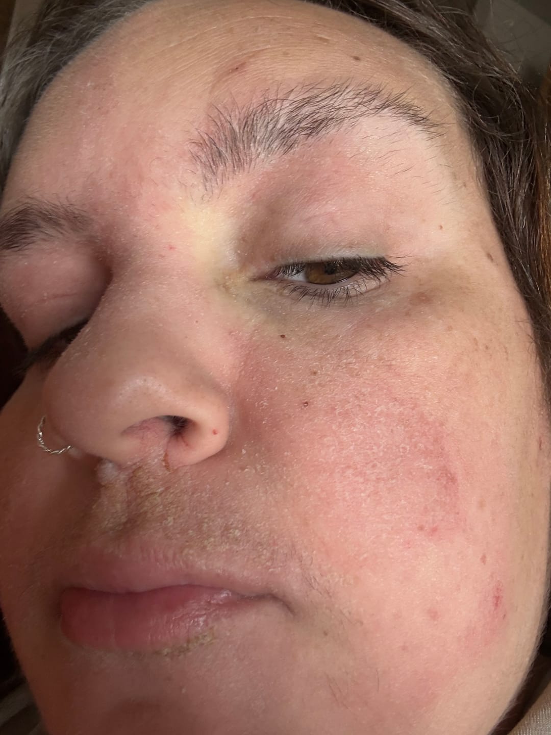 Customer photo review of Seb Natural Calming Serum