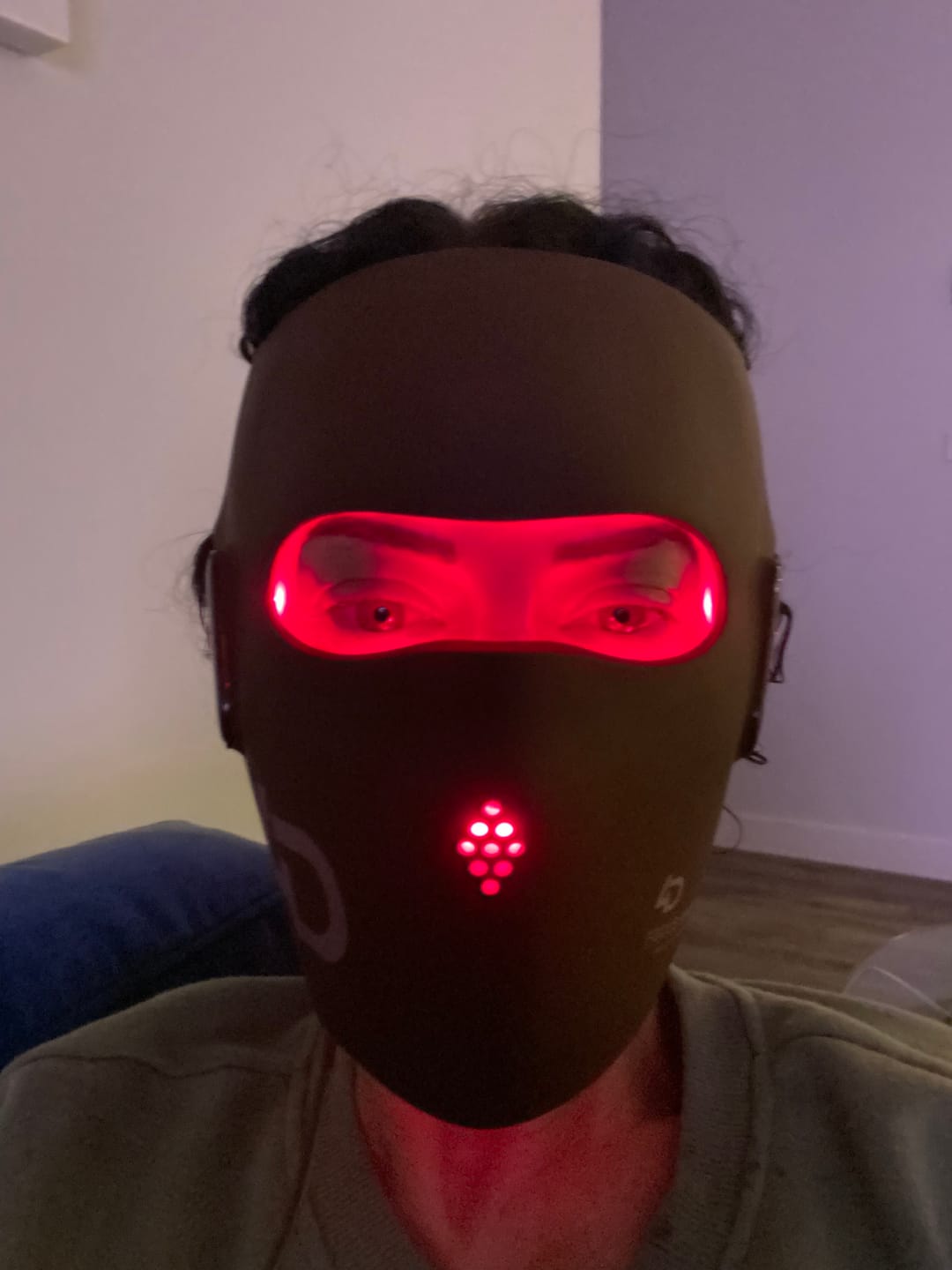Customer photo review of JOVS 4D Laser Light Therapy Mask
