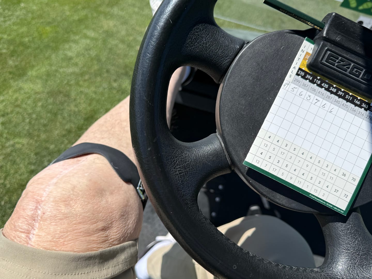 Customer photo review of Nayori Precision Strap – Knee Support That Moves With You