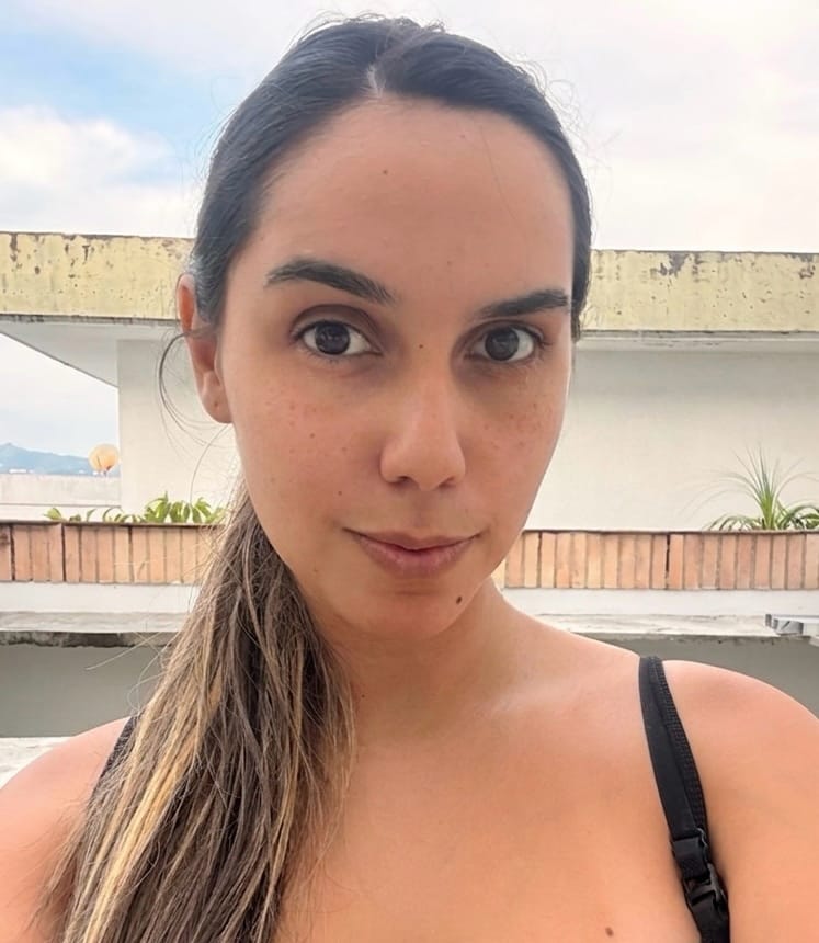 Customer photo review of Hyaluronic Moisture Serum (Anti Aging)