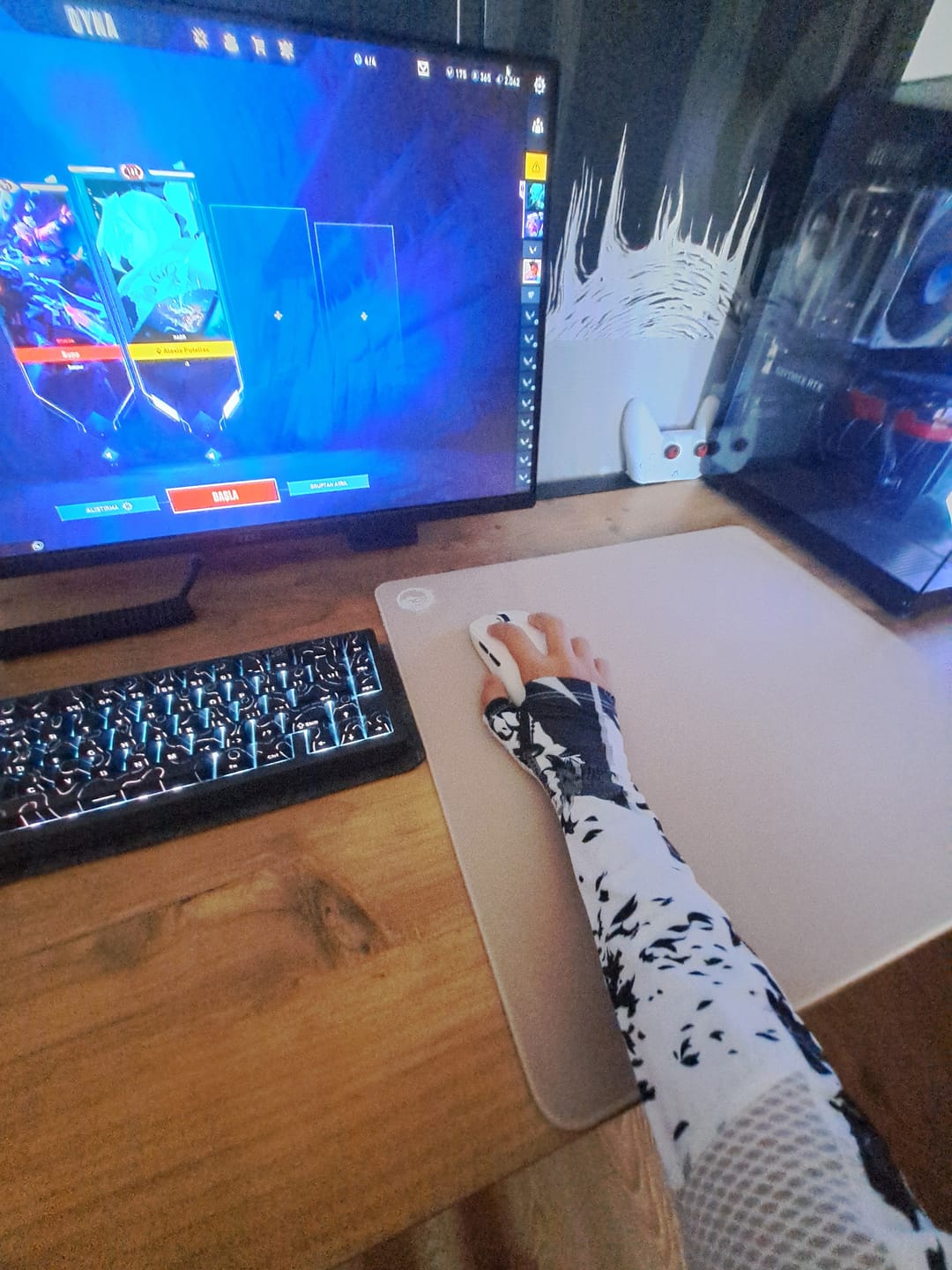Customer photo review of Wraith Esports Arm Sleeve