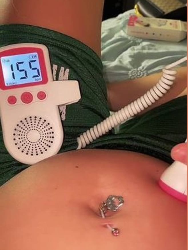 Customer photo review of Monitor de Latido BORNEX™