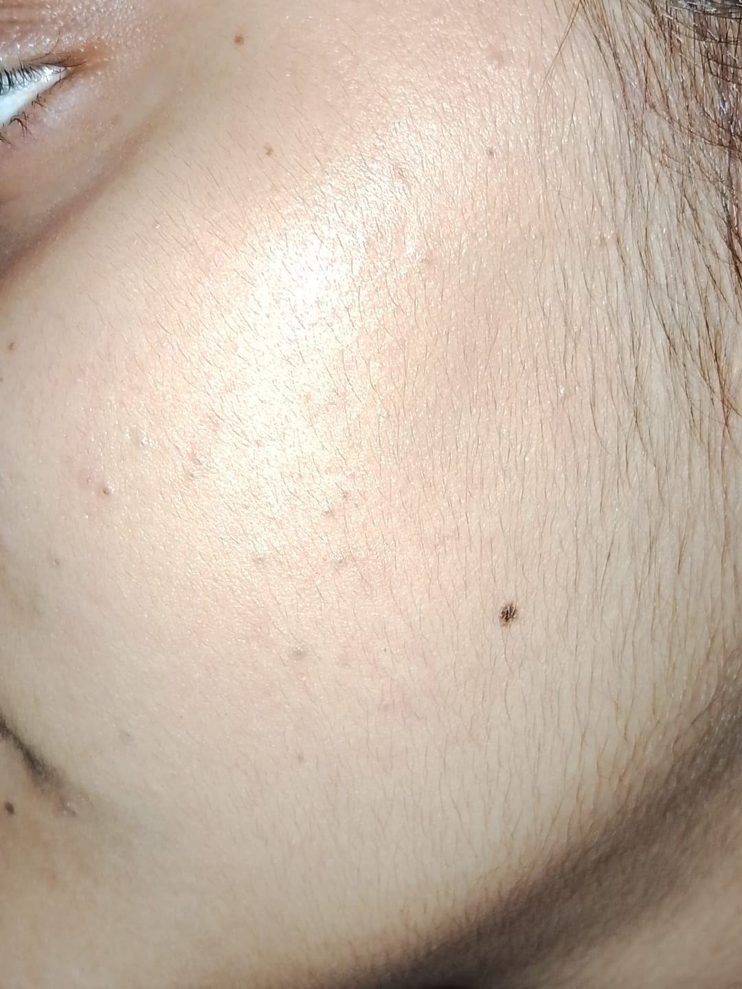 Customer photo review of Maxdif Brightening Cream