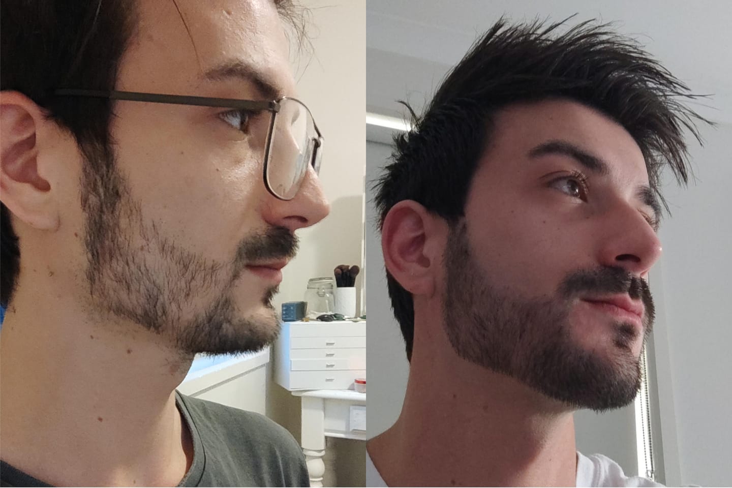 Customer photo review of Reverse - Beard Growth Serum