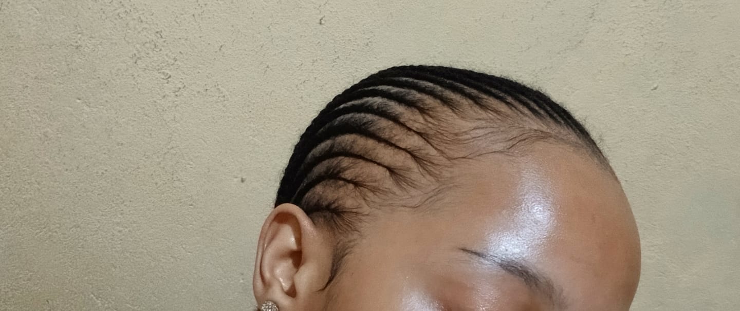 Customer photo review of Minoxidil 5% SOLUTION, 3 x 60ml pack
