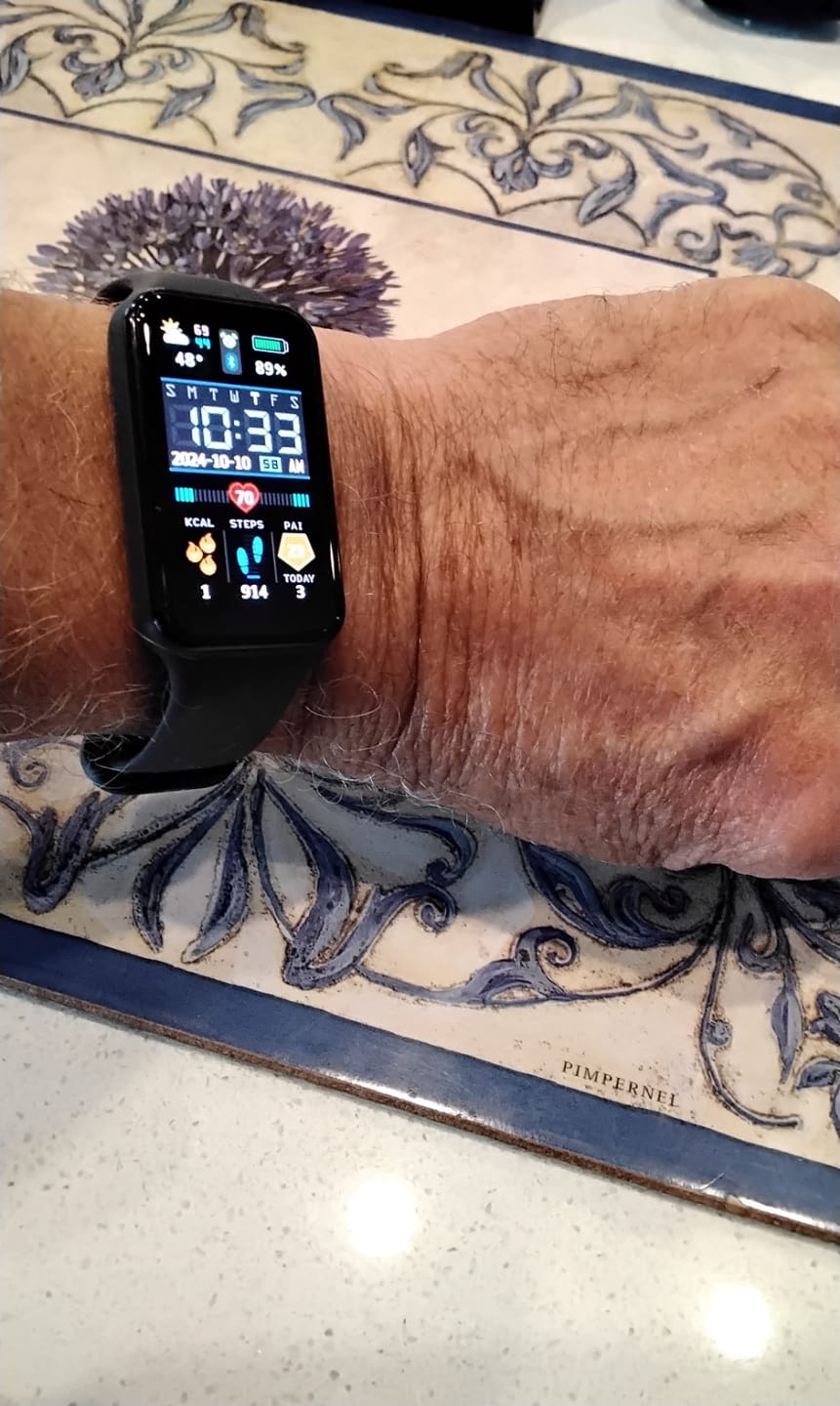 Customer photo review of Band 7