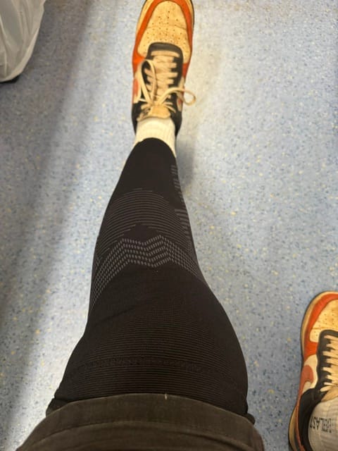 Customer photo review of KniTec V2 - Compression Sleeves For Knees & Legs
