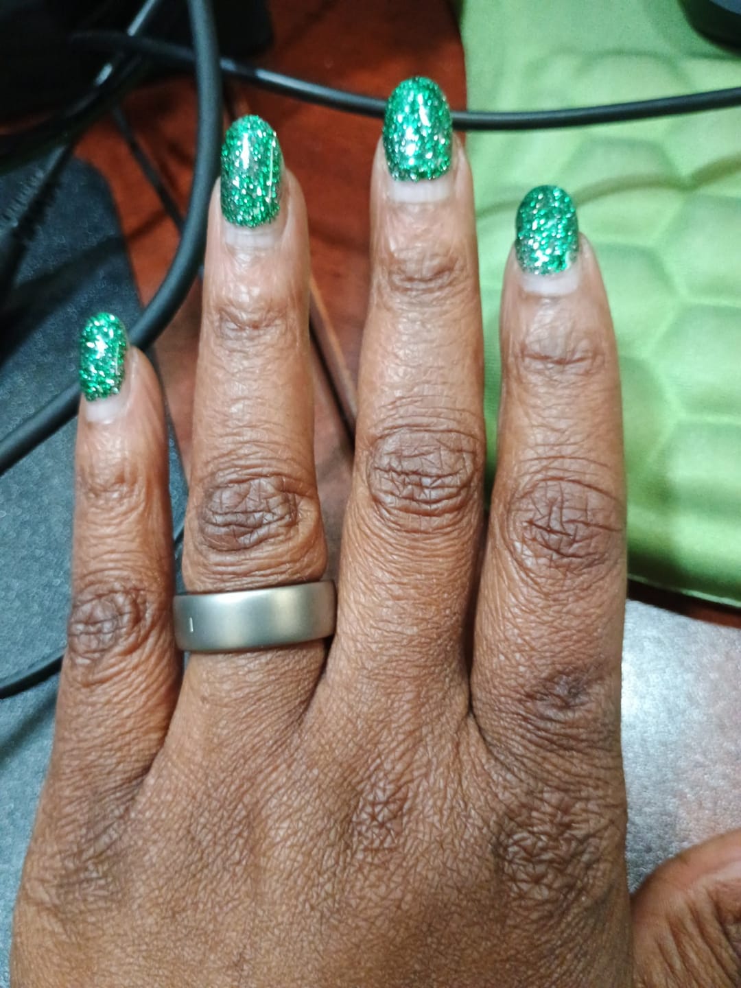 Customer photo review of Helio Ring