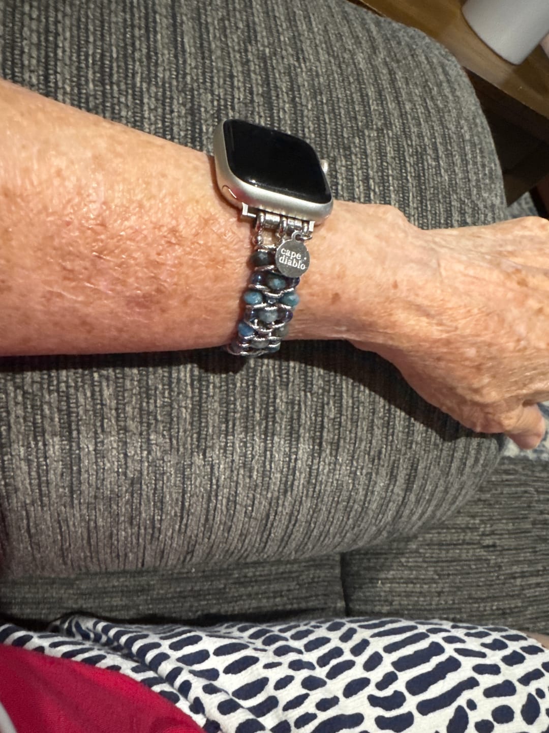 Customer photo review of Apatite Azure Braided Apple Watch Strap