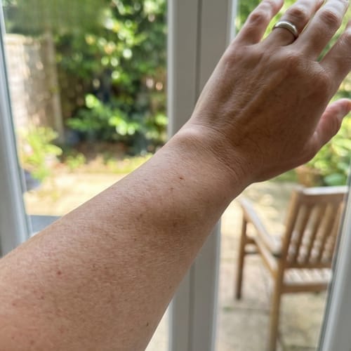 Customer photo review of Botanical Body Oil™