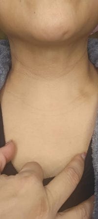 Customer photo review of Naperi™ Crema Age Reset