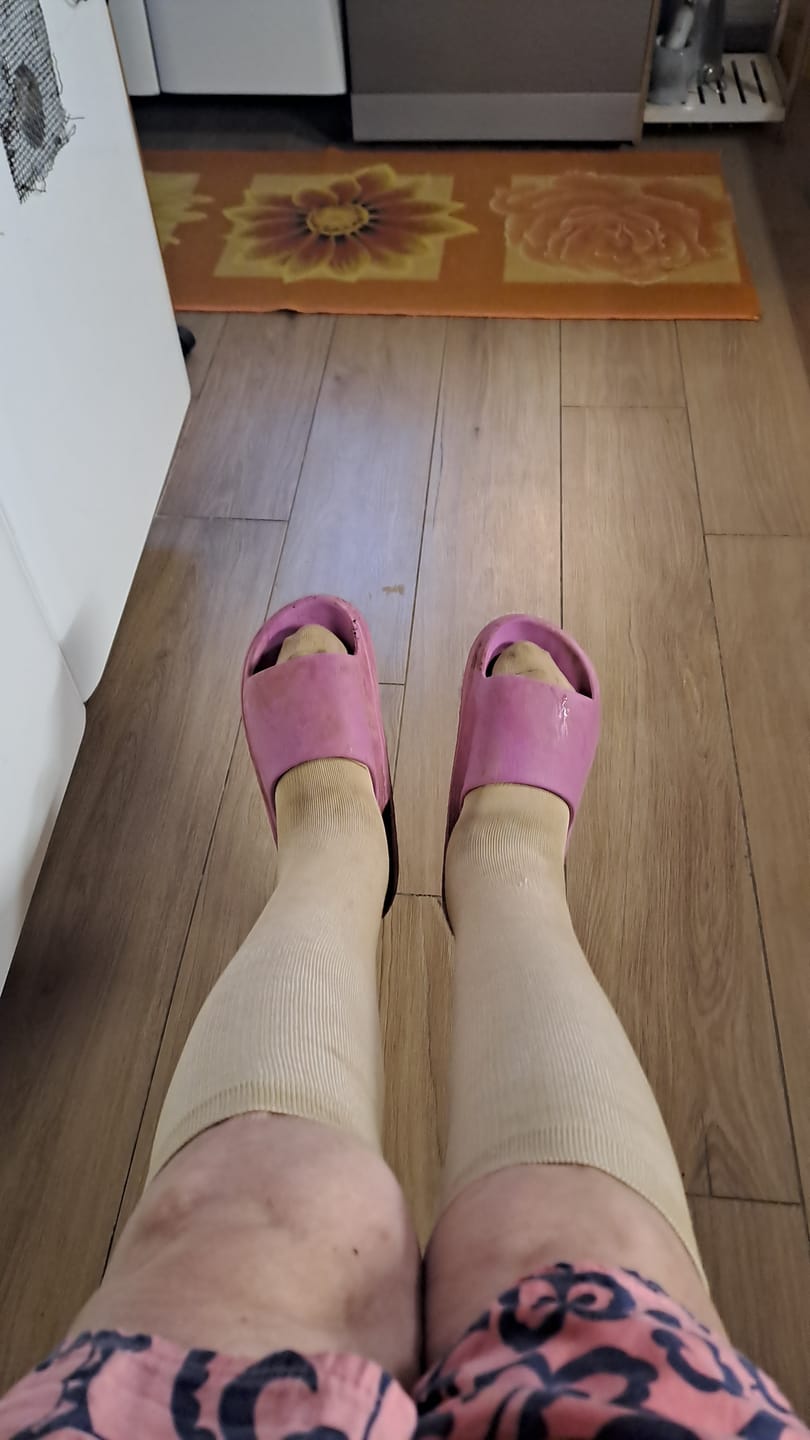 Customer photo review of Calze BambooFlow™ a Compressione punta CHIUSA – Gambe leggere tutto il giorno!