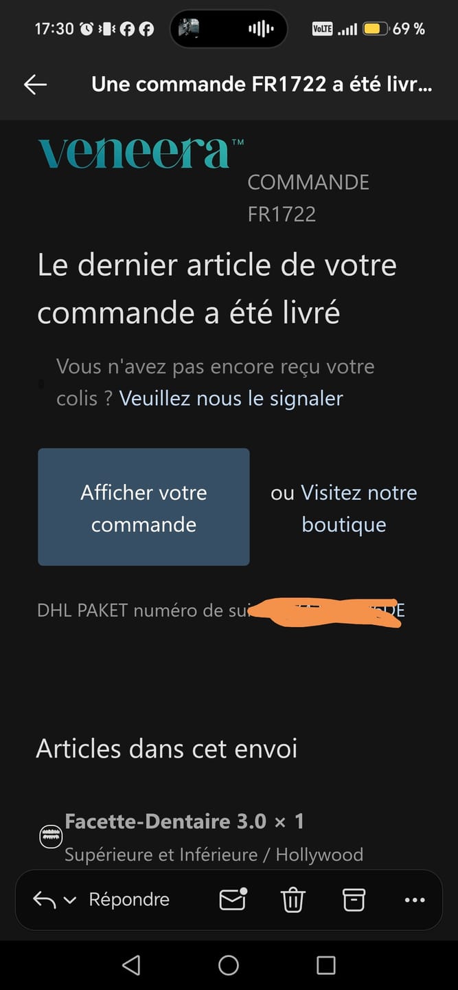 Customer photo review of Facette-Dentaire 3.0