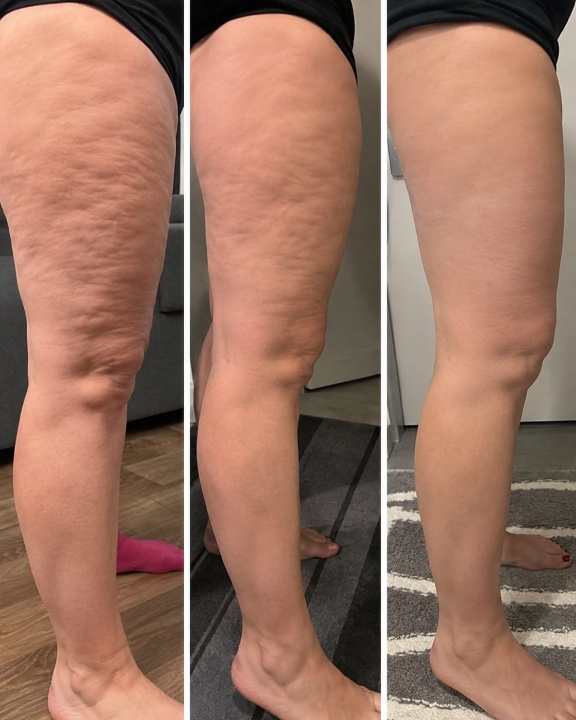 Customer photo review of ActiFlex 3D-Kompressionsleggings