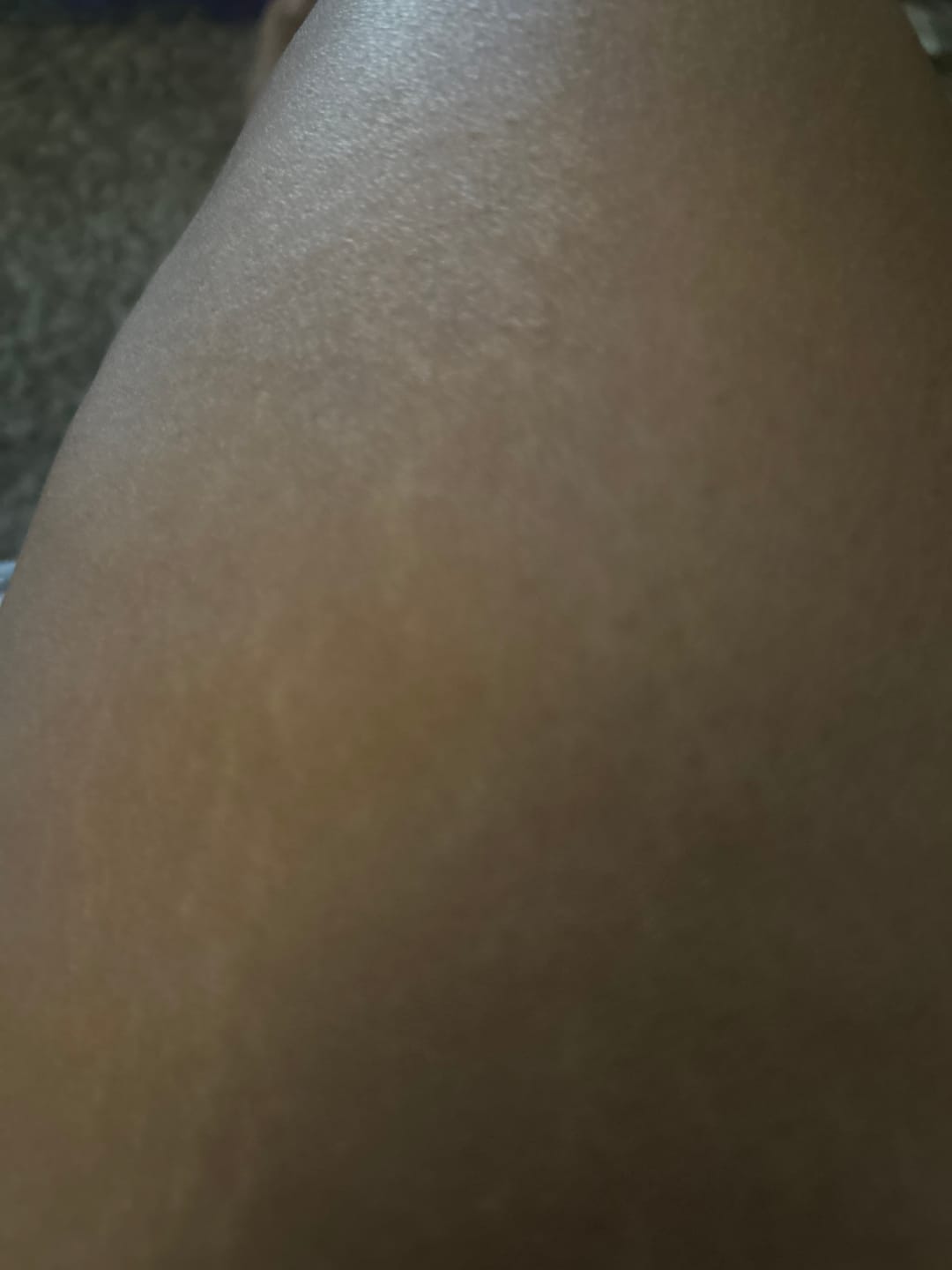 Customer photo review of Shimma™ Black Seed Oil Body Coverage Perfector