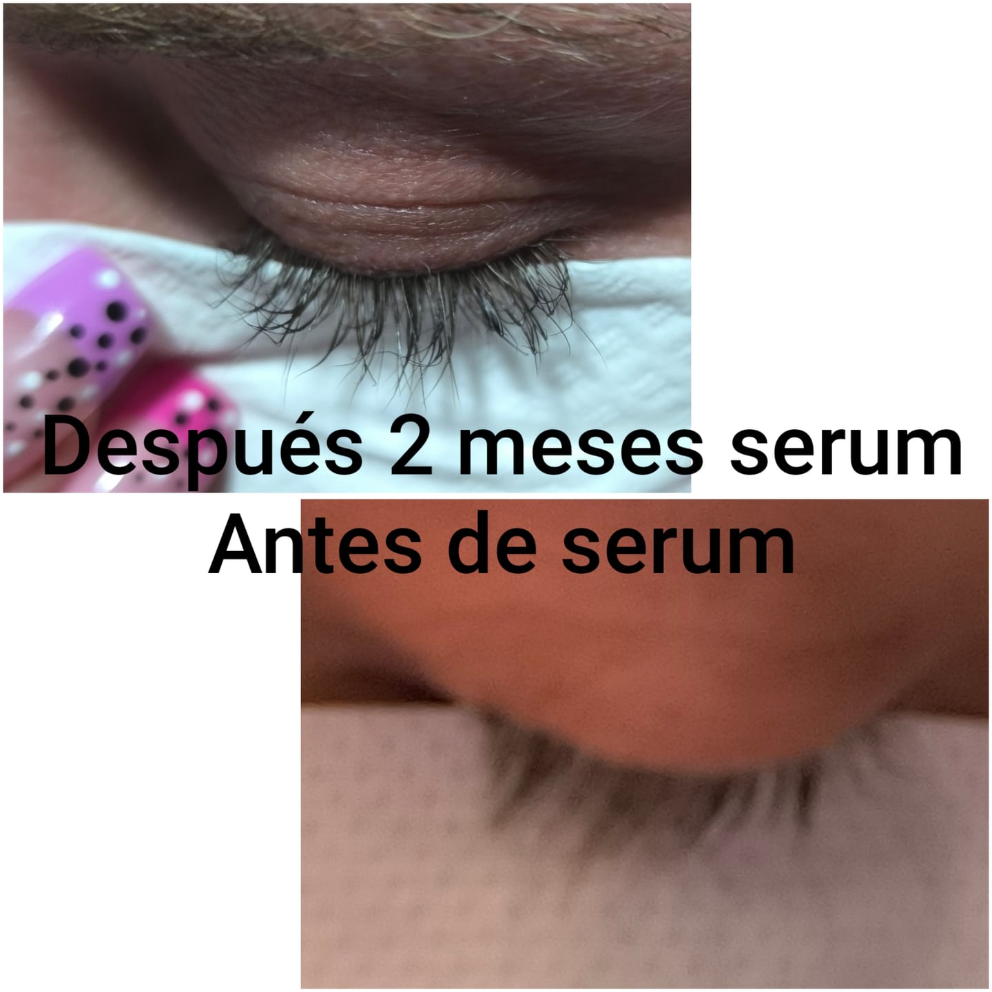 Customer photo review of KosmaLash Sérum | Crecimiento & Anticaída
