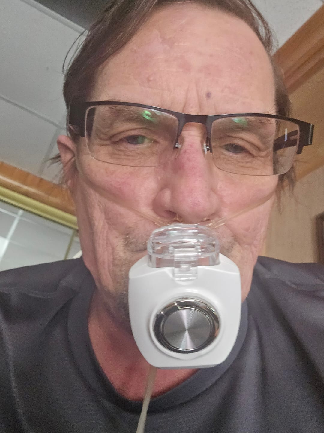 Customer photo review of Micro Mist Pro Portable Nebulizer