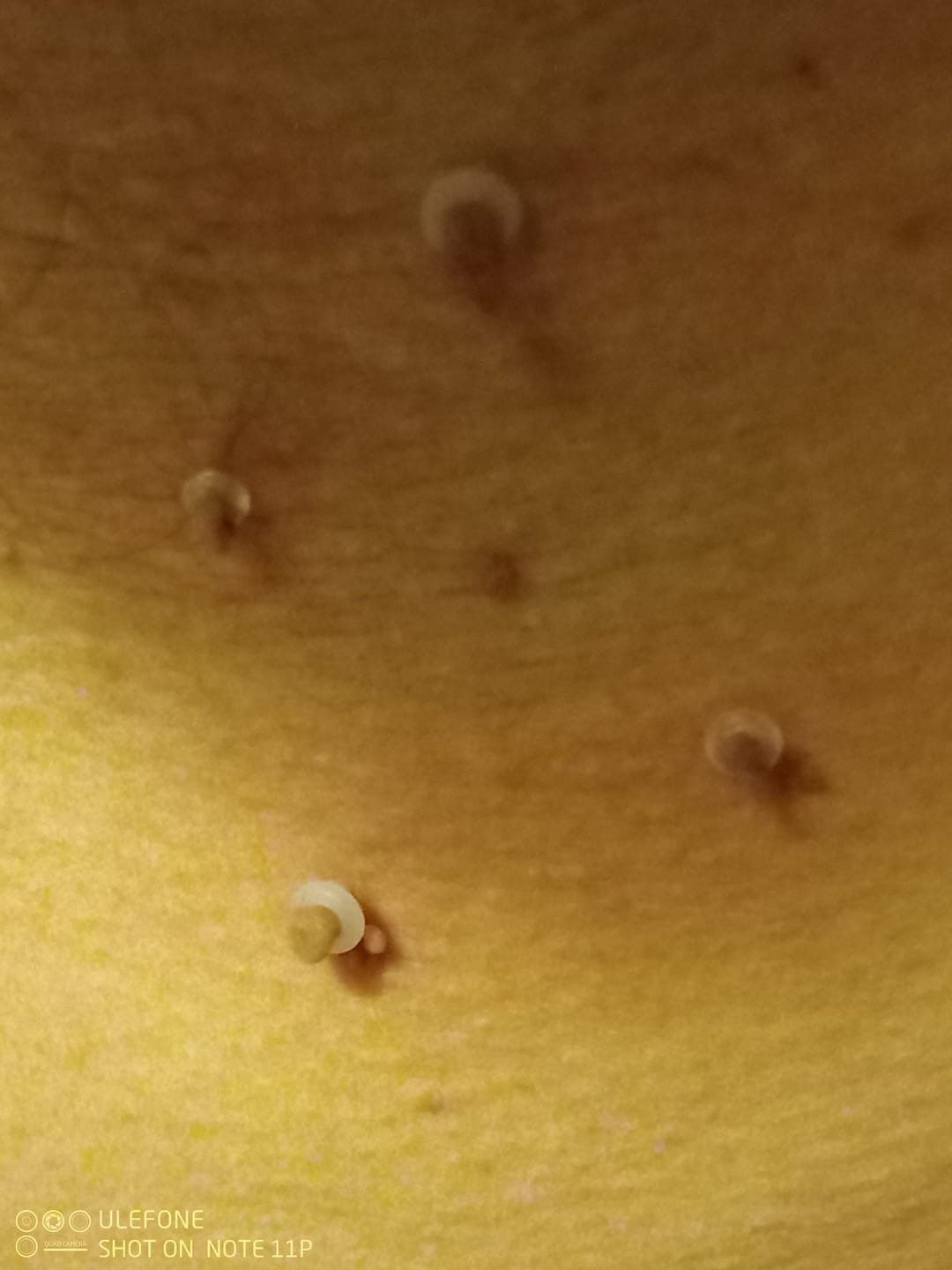 Customer photo review of Alcura™ Ersatzringe für Hautanhängsel