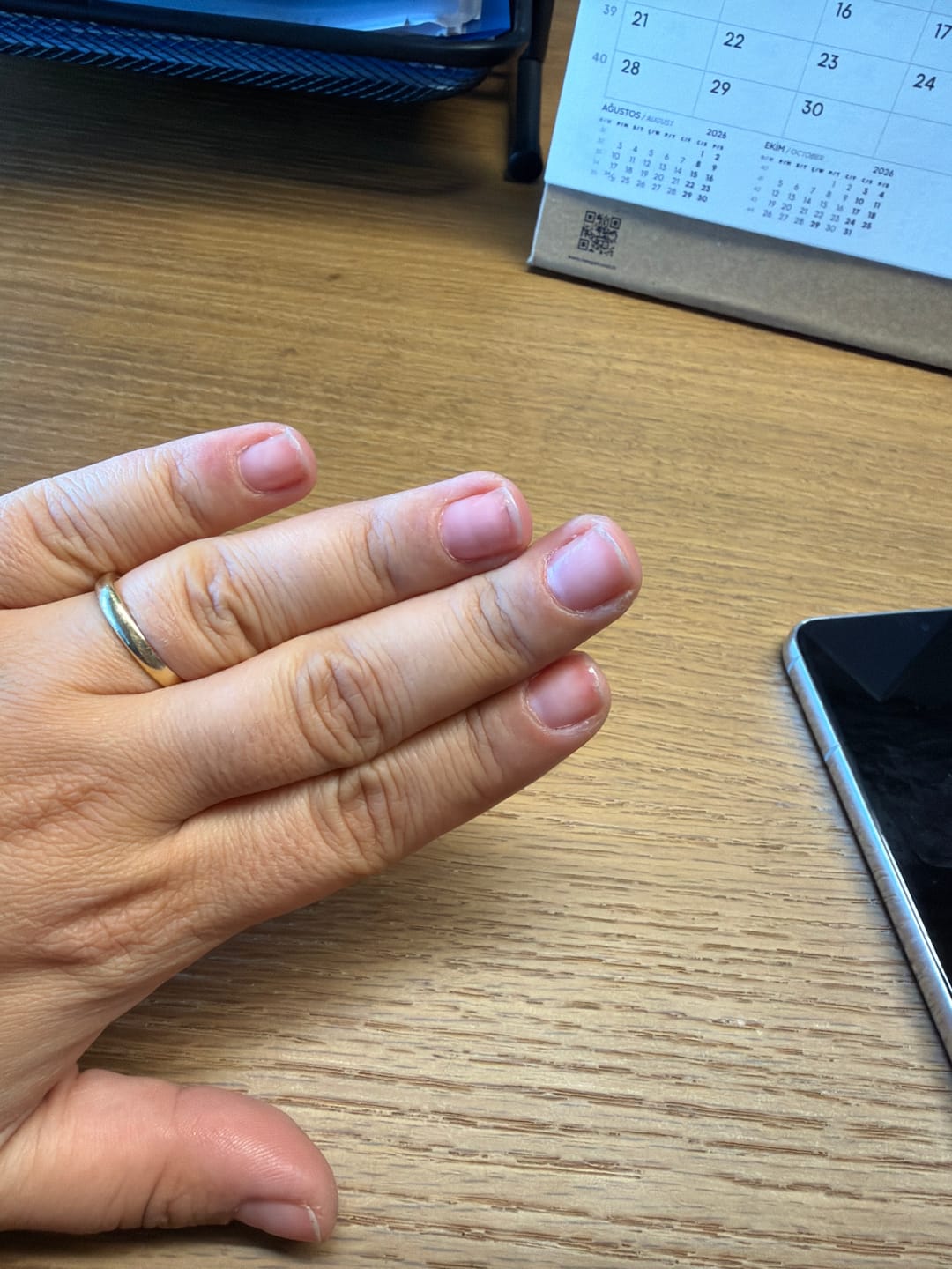 Customer photo review of [Kayısı] Renkli Tırnak Güçlendirici