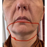 Customer photo review of Naperi™ Crema Age Reset