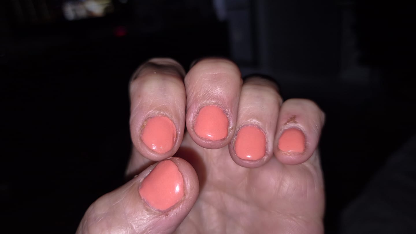 Customer photo review of Verwijderfolie (100 stuks)